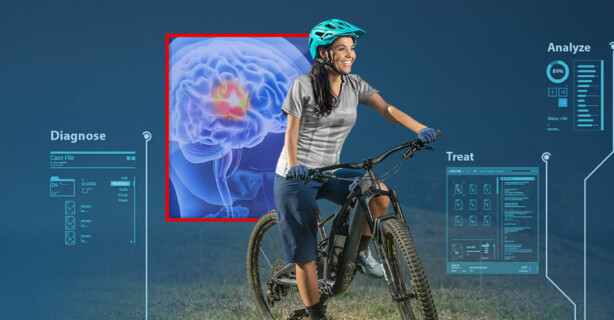 Stroke – Multimodality Insights Into the Patient Pathway