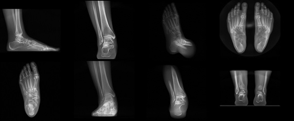 Advanced 3D Reconstruction software for CBCT and DRT