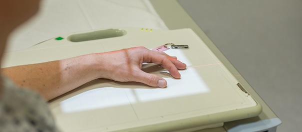 Tackling the osteoporosis crisis by calculating fracture risk from standard digital radiographs