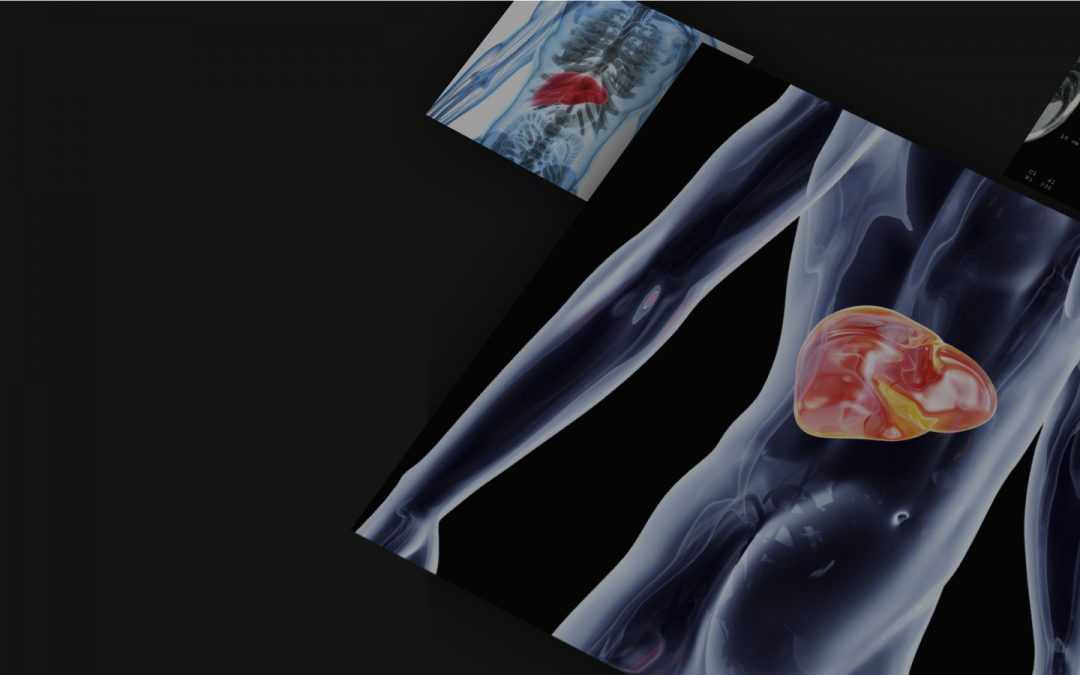 Liver lesions