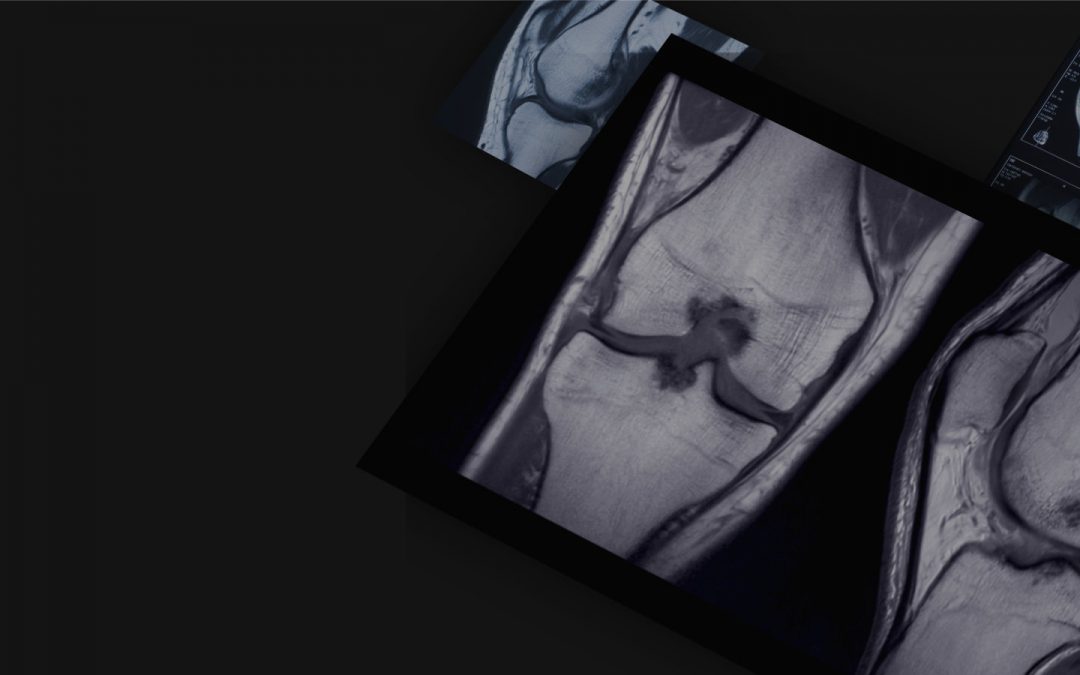 Physics and application of MRI (in knee imaging)