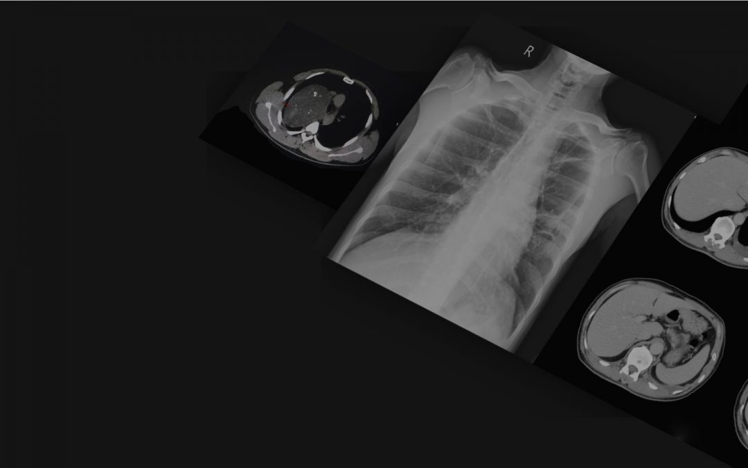ECR Academies: Chest Imaging