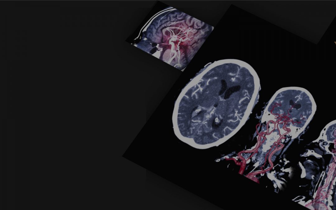 Neuro