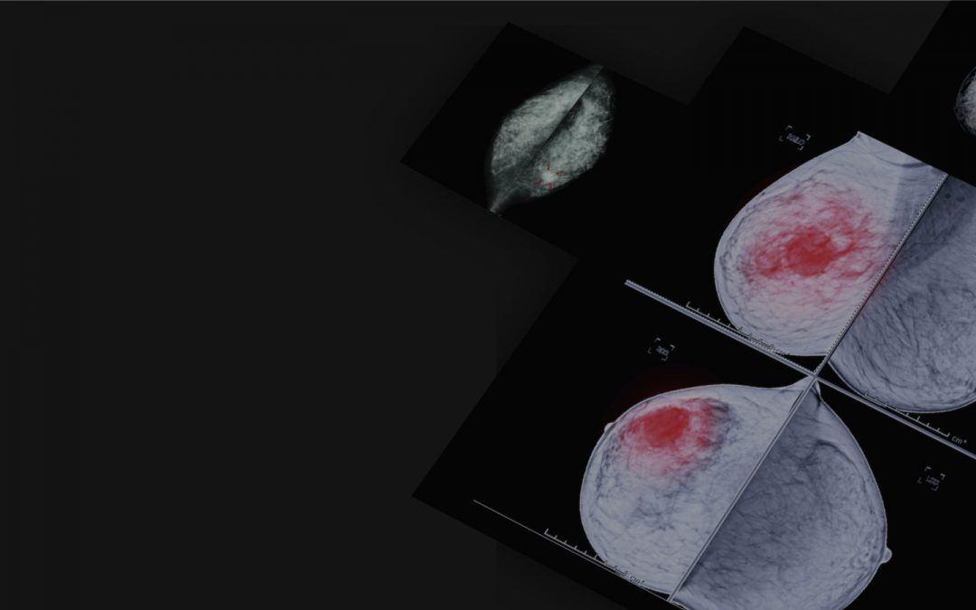 Breast imaging: basics