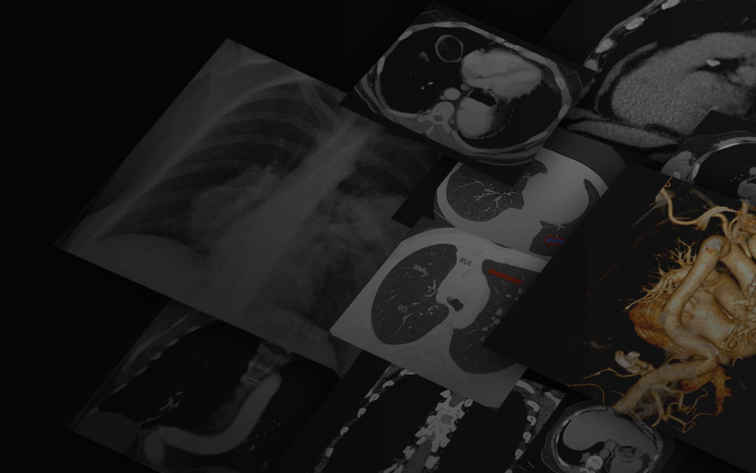 Chest Imaging: Basics