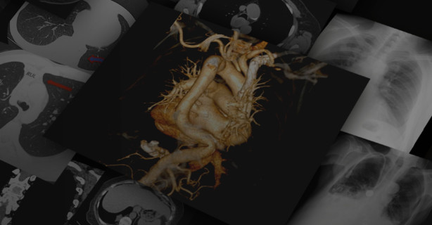 Chest Imaging: Basics